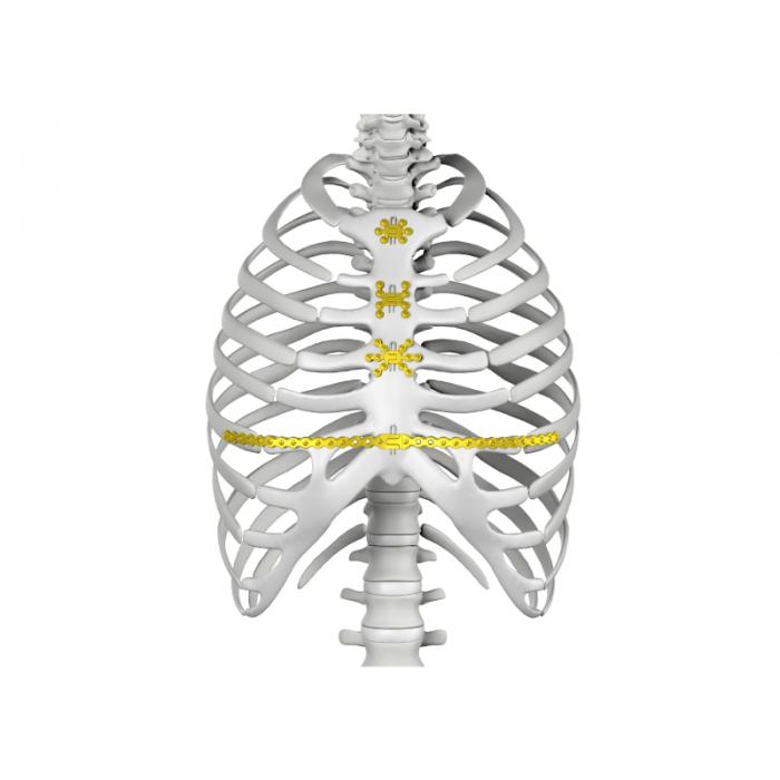 Thorax System