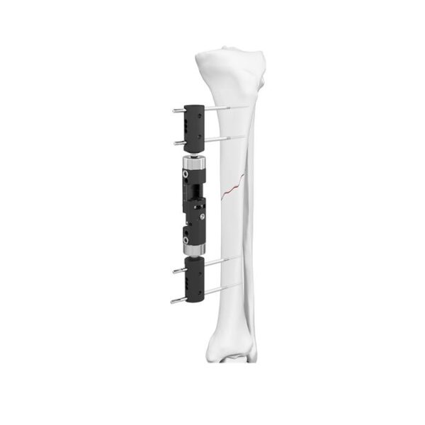 Dynamischer externer Fixateur
