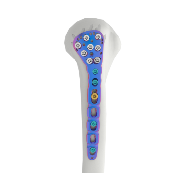 VAL Proximaler Humerusverriegelungsplatte